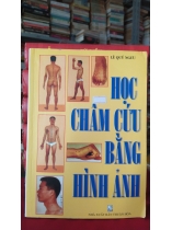 HỌC CHÂM CỨU BẰNG HÌNH ẢNH